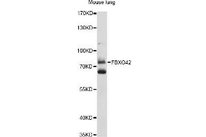 Western blot analysis of extracts of mouse lung, using FBXO42 antibody (ABIN6292072) at 1:1000 dilution.