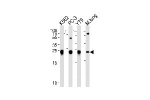 GSTP1 Antibody (Center) (ABIN1881393 and ABIN2842718) western blot analysis in K562,PC-3,Y79 cell line and mouse lung tissue lysates (35 μg/lane). (GSTP1 抗体  (AA 97-126))