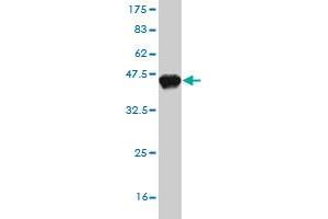 Western Blot detection against Immunogen (37. (PHIP 抗体  (AA 1599-1705))