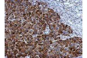 Image no. 1 for anti-Nucleolar Protein 3 (Apoptosis Repressor with CARD Domain) (NOL3) (AA 1-197) antibody (ABIN1501899)