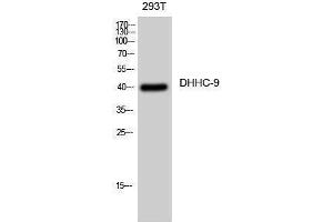 Western Blotting (WB) image for anti-Zinc Finger, DHHC-Type Containing 9 (ZDHHC9) (C-Term) antibody (ABIN3174756) (ZDHHC9 抗体  (C-Term))