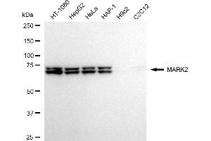 Western blotting analysis using MARK2 antibody (ABIN7799333). (Recombinant MARK2 抗体)