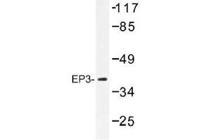 Image no. 1 for anti-Prostaglandin E Receptor 3 (Subtype EP3) (PTGER3) antibody (ABIN317859) (PTGER3 抗体)