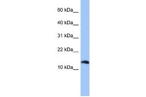 WB Suggested Anti-PTH2 Antibody Titration: 0. (Parathyroid Hormone 2 (PTH2) (Middle Region) 抗体)