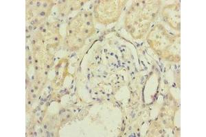Immunohistochemistry (IHC) image for anti-Mago-Nashi Homolog (MAGOH) (AA 1-146) antibody (ABIN7165791)