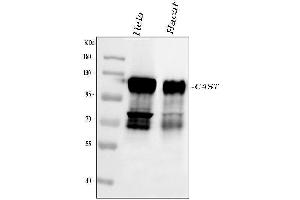 Western blot analysis of Calpastatin using anti-Calpastatin antibody (ABIN4886503).