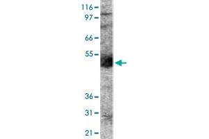 Western blot analysis of PODXL in human lung lysate using with PODXL polyclonal antibody . (PODXL 抗体  (AA 100-200))
