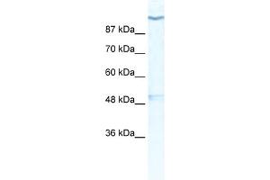 WB Suggested Anti-KCNH6 Antibody Titration:  0. (KCNH6 抗体  (Middle Region))