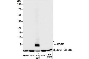 Western Blotting (WB) image for anti-Calcitonin-Related Polypeptide alpha (CALCA) (AA 75-125) antibody (ABIN7452578) (Recombinant CGRP 抗体  (AA 75-125))