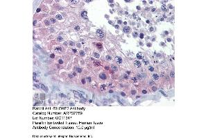Human Testis (RHOXF2 抗体  (Middle Region))
