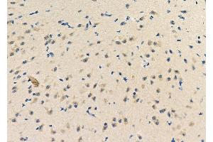 ABIN6257564 and ABIN6275690 at 1/100 staining Mouse brain tissue by IHC-P.