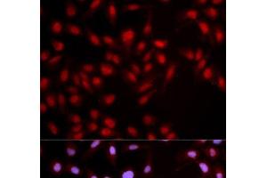 Immunofluorescence analysis of U2OS cells using Phospho-MET(Y1349) Polyclonal Antibody (c-MET 抗体  (pTyr1349))