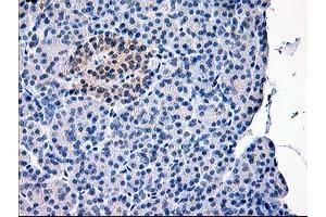 Image no. 1 for anti-Calpain 9 (CAPN9) antibody (ABIN1497092) (Calpain 9 抗体)