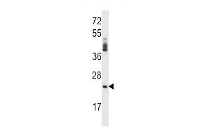 PRSS2 Antibody (Center) (ABIN657641 and ABIN2846637) western blot analysis in NCI- cell line lysates (35 μg/lane). (PRSS2 抗体  (AA 80-108))