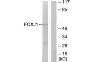 Western blot analysis of extracts from LOVO cells, using FOXJ1 Antibody. (FOXJ1 抗体  (AA 271-320))