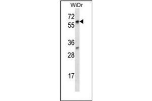 Western blot analysis of LARP7 Antibody (C-term) in WiDr cell line lysates (35ug/lane). (LARP7 抗体  (C-Term))