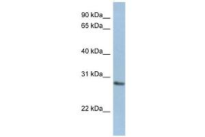 NANP antibody used at 1 ug/ml to detect target protein. (NANP 抗体  (Middle Region))