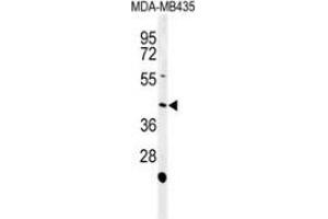 Western blot analysis of NOXA1 (arrow) in MDA-MB435 cell line lysates (35ug/lane) using NOXA1  Antibody (C-term).