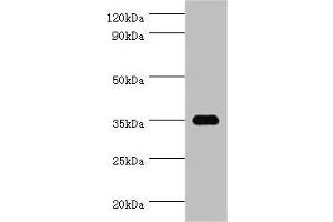 Western blot All lanes: SULT1C2 antibody at 5 μg/mL + Hela whole cell lysate Secondary Goat polyclonal to rabbit IgG at 1/10000 dilution Predicted band size: 35, 36 kDa Observed band size: 35 kDa (SULT1C2 抗体  (AA 1-120))