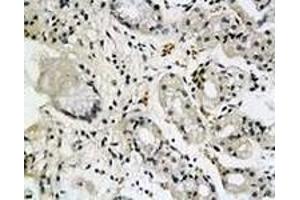 Immunohistochemiacl staining of human antrum tissue section with SCTR polyclonal antibody  at 1:200 dilution. (SCTR 抗体)