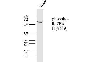 U2OS cell lysates probed with Rabbit Anti-IL-7Ra(Tyr449) Polyclonal Antibody, Unconjugated  at 1:500 for 90 min at 37˚C. (IKBKG 抗体  (pSer43))