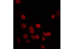 Immunofluorescence (fixed cells) (IF/ICC) image for anti-TAF5-Like RNA Polymerase II, P300/CBP-Associated Factor (PCAF)-Associated Factor, 65kDa (TAF5L) (Internal Region) antibody (ABIN6265439)