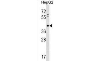 Western Blotting (WB) image for anti-Lipid Phosphate Phosphatase-Related Protein Type 5 (LPPR5) antibody (ABIN2998648) (LPPR5 抗体)
