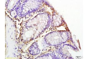 Immunohistochemistry (Paraffin-embedded Sections) (IHC (p)) image for anti-Interleukin 1, beta (IL1B) (AA 161-269) antibody (ABIN872644)