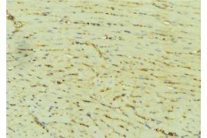 Immunohistochemistry (IHC) image for anti-ATPase, Ca++ Transporting, Cardiac Muscle, Slow Twitch 2 (ATP2A2) (Internal Region) antibody (ABIN6260121)