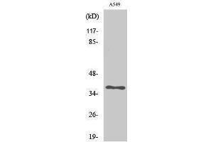 Western Blotting (WB) image for anti-Aldo-Keto Reductase Family 1, Member E2 (AKR1E2) (Internal Region) antibody (ABIN3183228) (AKR1E2 抗体  (Internal Region))