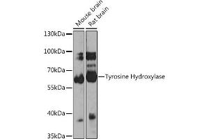 Western blot analysis of extracts of various cell lines, using Tyrosine Hydroxylase antibody (ABIN1683183, ABIN3015012, ABIN3015013 and ABIN6213590) at 1:1000 dilution. (Tyrosine Hydroxylase 抗体)