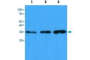 Western blot analysis of Lane 1: HeLa cell lysate, Lane 2: HepG2 cell lysate and Lane 3: 293T cell lysate with CBR1 monoclonal antibody, clone AT4E12  at 1:1000 dilution followed by HRP-conjugated goat anti-mouse secondary antibody and visualized by ECL detection system. (CBR1 抗体)