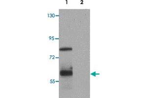Western blot analysis of IRF4 in Jurkat cell lysate with IRF4 polyclonal antibody  at 1 ug/mL. (IRF4 抗体  (C-Term))