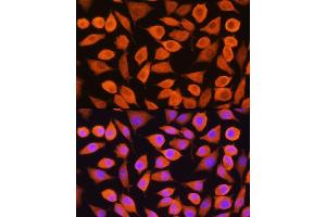 Immunofluorescence analysis of L929 cells using Cytokeratin 5 (Cytokeratin 5 (KRT5)) Rabbit pAb (ABIN3016404, ABIN3016405, ABIN3016406 and ABIN6219743) at dilution of 1:100. (Cytokeratin 5 抗体)