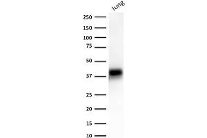 ABIN6383801 to EpCAM was successfully used to stain an approx. (EpCAM 抗体  (Extracellular Domain))
