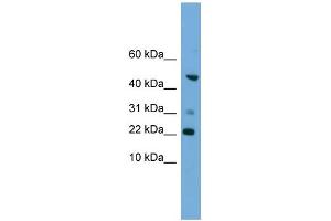 WB Suggested Anti-RAC1 Antibody Titration: 0. (RAC1 抗体  (Middle Region))