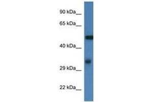 Image no. 1 for anti-Fascin (FSCN1) (AA 93-142) antibody (ABIN6746004)