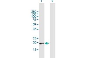 Western Blot analysis of CLEC3A expression in transfected 293T cell line by CLEC3A MaxPab polyclonal antibody.