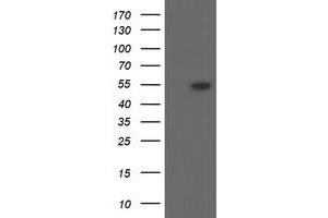 Western Blotting (WB) image for anti-Diphthamide Biosynthesis Protein 2 (DPH2) antibody (ABIN1497891) (DPH2 抗体)