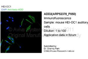 Image no. 2 for anti-Adducin 2 (Beta) (ADD2) (Middle Region) antibody (ABIN406210) (ADD2 抗体  (Middle Region))