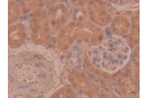 DAB staining on IHC-P; Samples: Mouse Kidney Tissue (PEDF 抗体  (AA 125-261))
