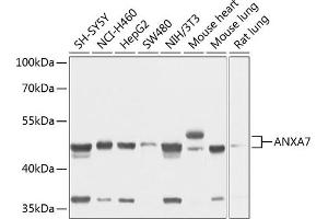Western blot analysis of extracts of various cell lines, using  antibody (ABIN1678673, ABIN3018016, ABIN3018017 and ABIN6220336) at 1:1000 dilution. (Annexin VII 抗体  (AA 237-466))
