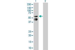 Western Blot analysis of LRIT3 expression in transfected 293T cell line by LRIT3 MaxPab polyclonal antibody. (LRIT3 抗体  (AA 1-552))