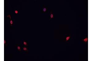 ABIN6266767 staining HeLa cells by IF/ICC. (ATRX 抗体  (N-Term))