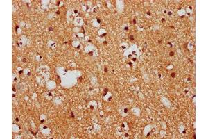 IHC image of ABIN7152731 diluted at 1:400 and staining in paraffin-embedded human brain tissue performed on a Leica BondTM system. (FEZF1 抗体  (AA 1-115))
