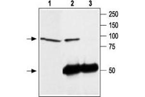 Immunoprecipitation of rat brain lysate: - 1. (TRPC4 抗体  (C-Term, Intracellular))