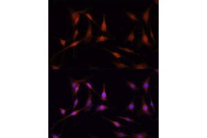 Immunofluorescence (IF) image for anti-FK506 Binding Protein 5 (FKBP5) (AA 308-457) antibody (ABIN1679852)