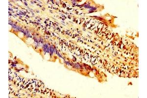 IHC image of ABIN7173504 diluted at 1:200 and staining in paraffin-embedded human small intestine tissue performed on a Leica BondTM system. (Dnmt2 抗体  (AA 170-269))