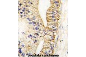 Immunohistochemistry (IHC) image for anti-Cadherin 7 (CDH7) antibody (ABIN2998181) (Cadherin 7 抗体)