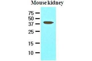 The extracts of mouse kidney (50 ug) were resolved by SDS-PAGE, transferred to nitrocellulose membrane and probed with anti-human PDCD12 (1:1000). (AVEN 抗体  (AA 254-362))